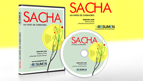 “Sacha, un niño de Chernobyl” “Sacha, un niño de Chernobyl”