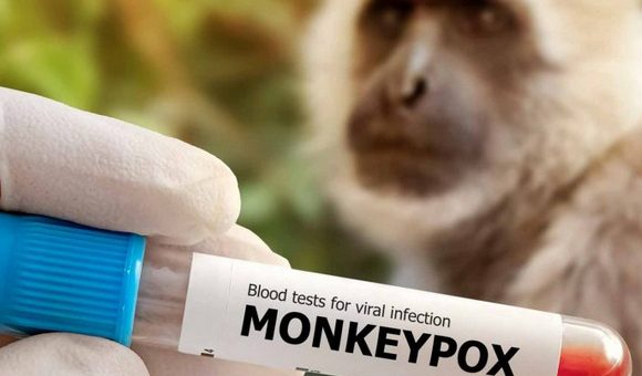 Imagen ilustrativa. Foto: Consultor Salud. Imagen ilustrativa. Foto: Consultor Salud.